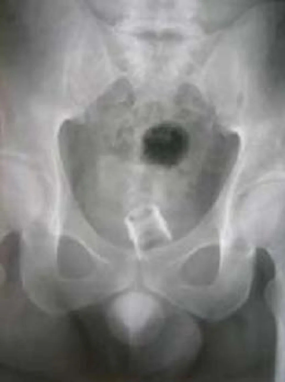 Abdomen radiograph for self-assessment