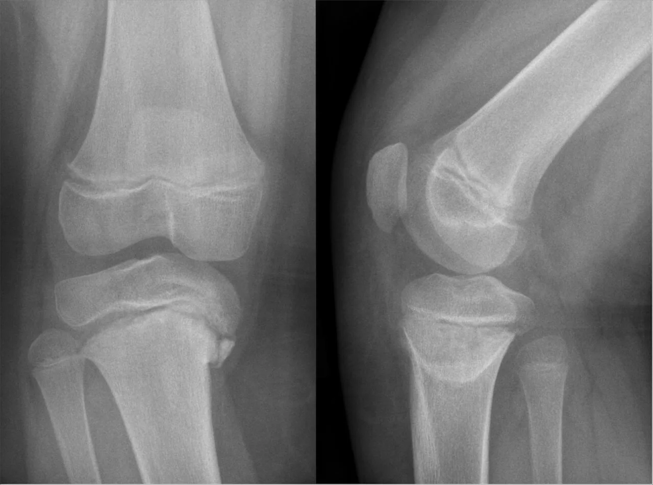 Paediatric radiograph for self-assessment