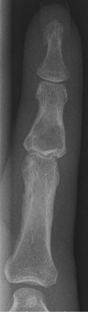 Bone & joint disease radiograph for self-assessment