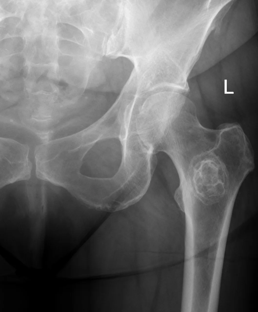 Bone & joint disease radiograph for self-assessment