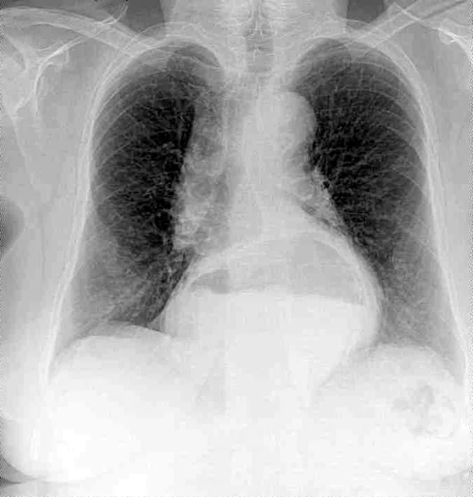 Chest radiograph for self-assessment
