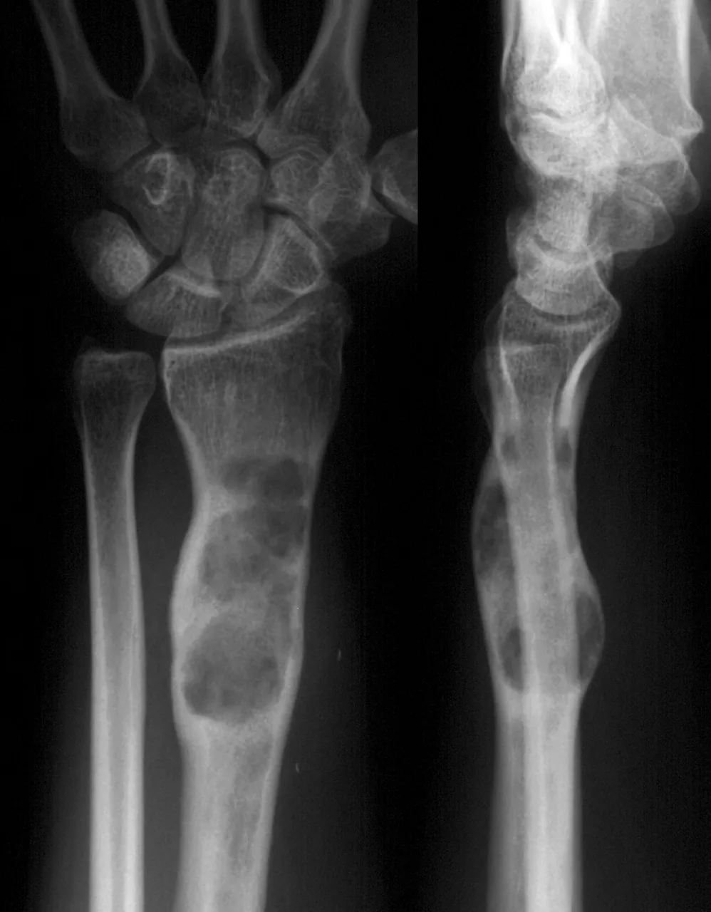 Bone & joint disease radiograph for self-assessment