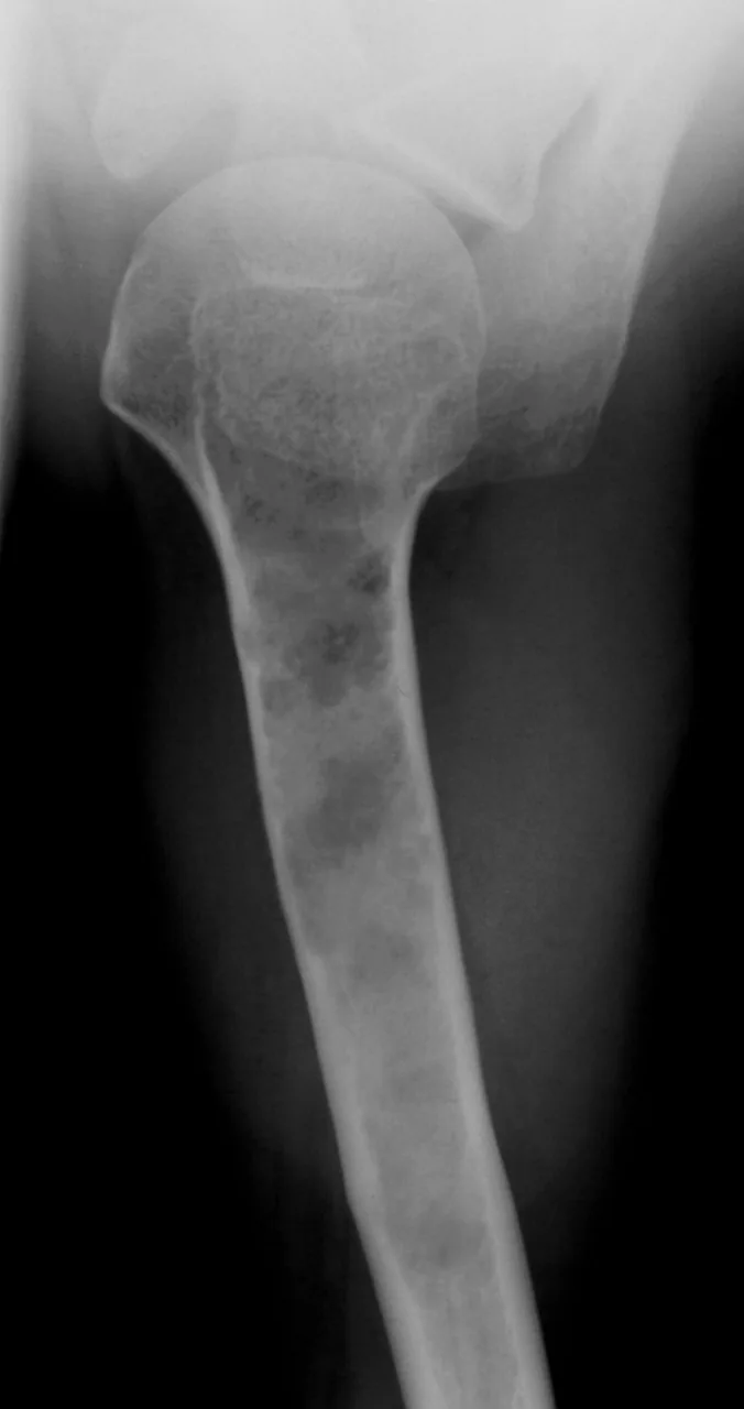 Bone & joint disease radiograph for self-assessment