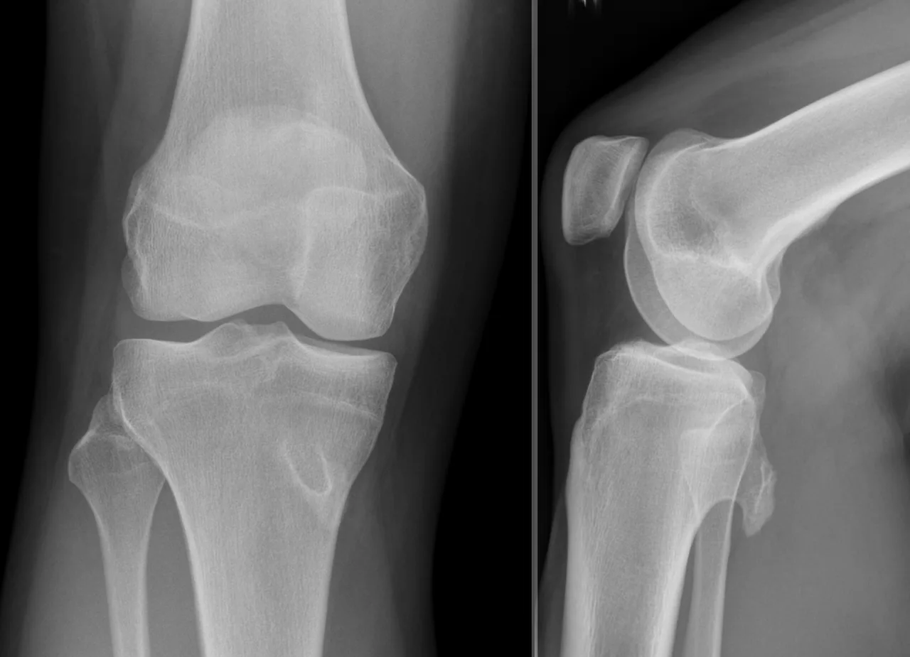 Bone & joint disease radiograph for self-assessment