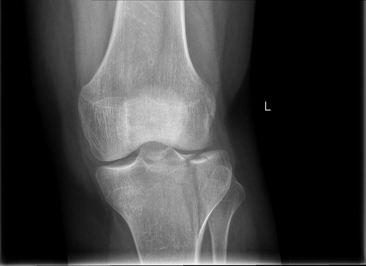 Lower limb radiograph for self-assessment