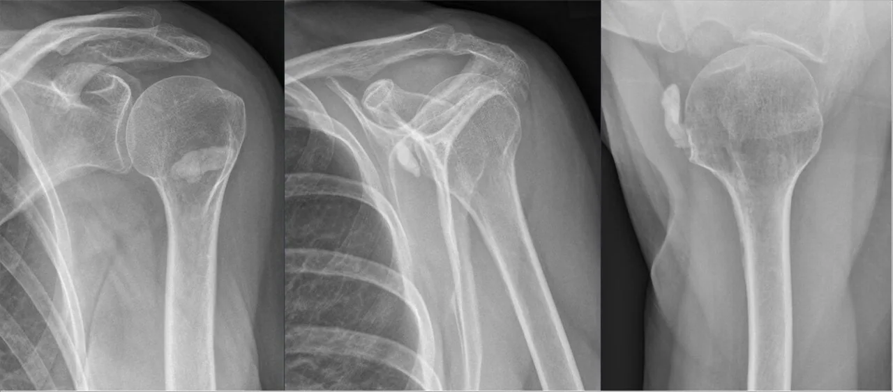 Upper limb radiograph for self-assessment