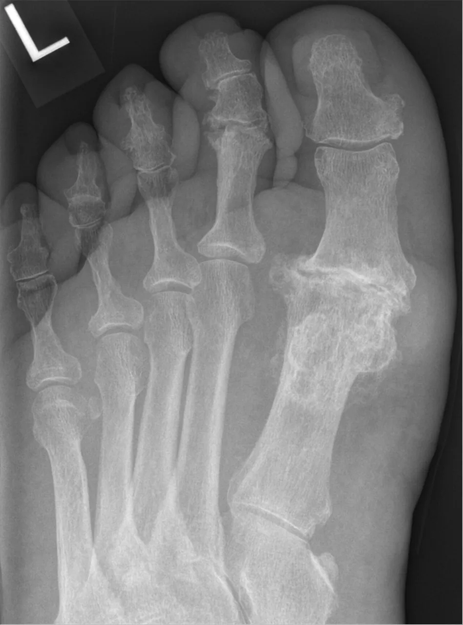 Bone & joint disease radiograph for self-assessment