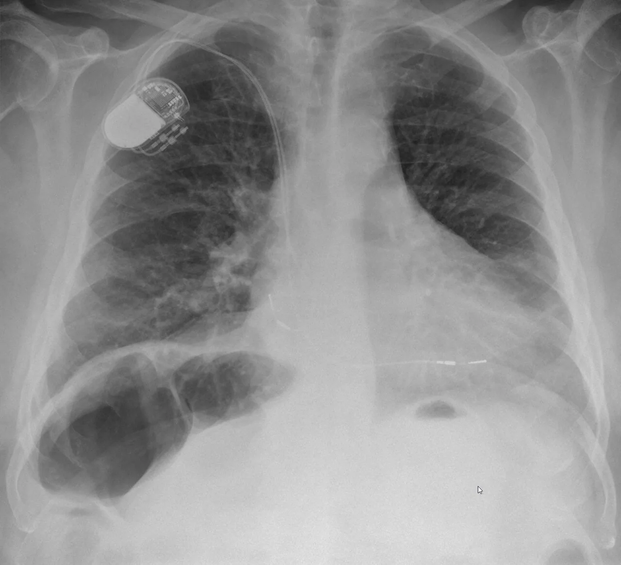 Abdomen radiograph for self-assessment