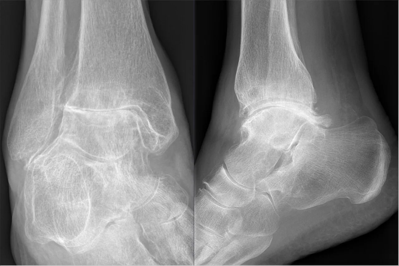 Bone & joint disease radiograph for self-assessment