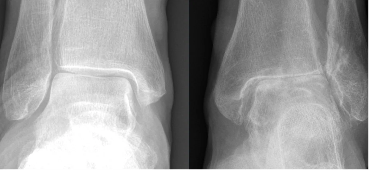 Bone & joint disease radiograph for self-assessment