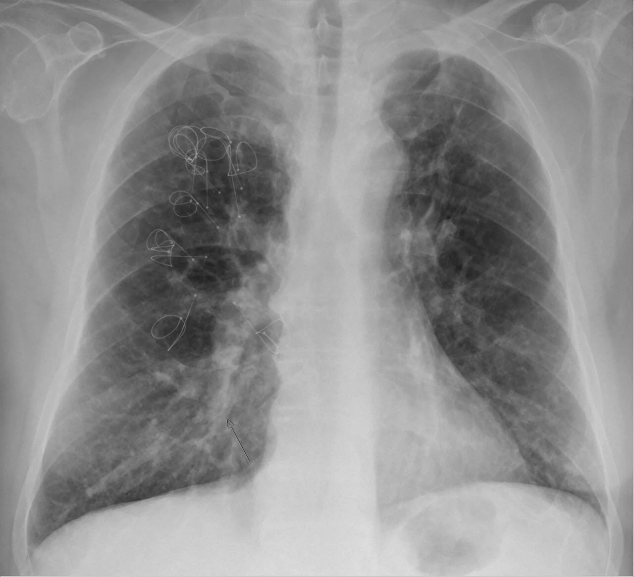 Chest radiograph for self-assessment