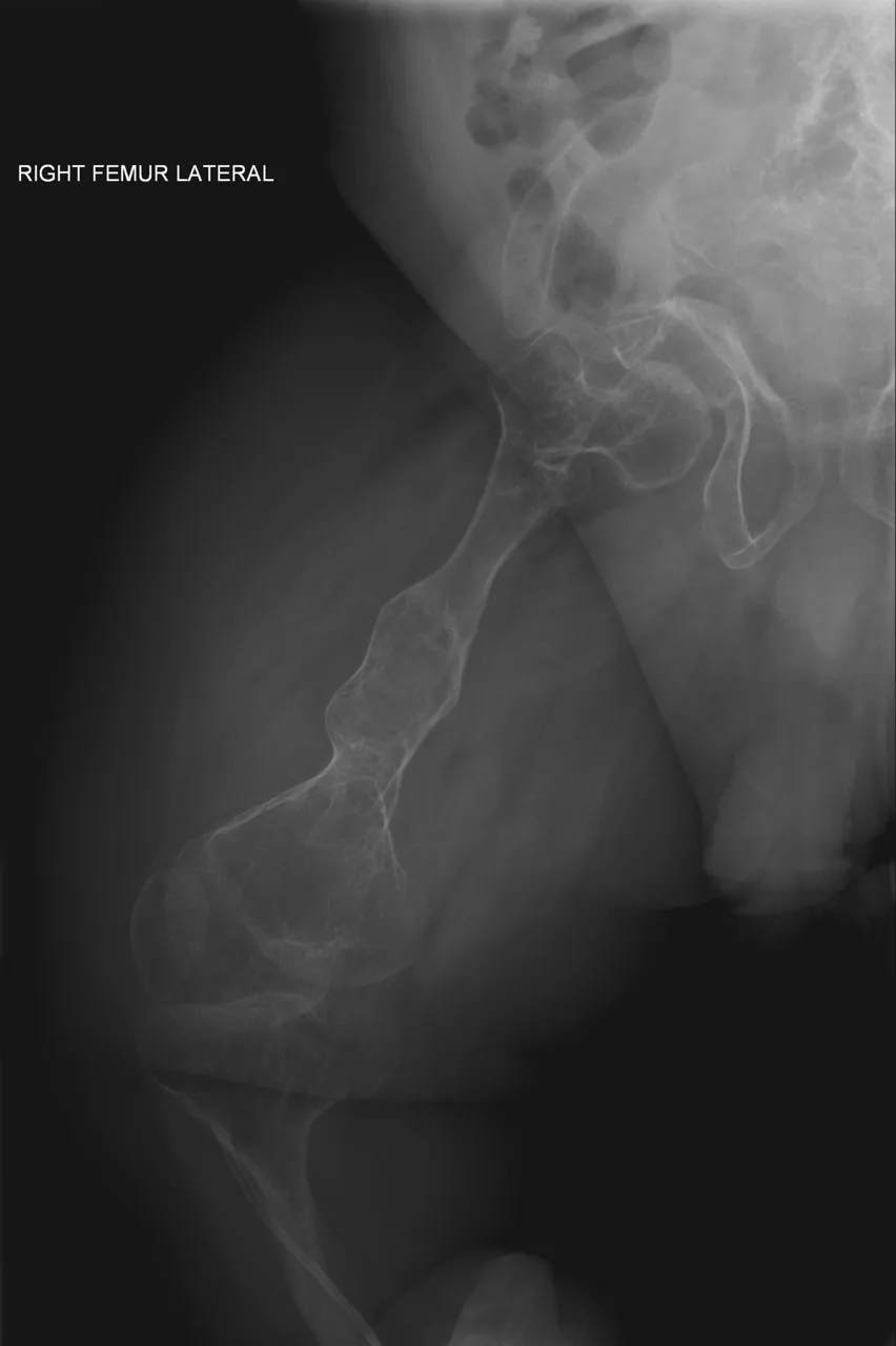 Paediatric radiograph for self-assessment