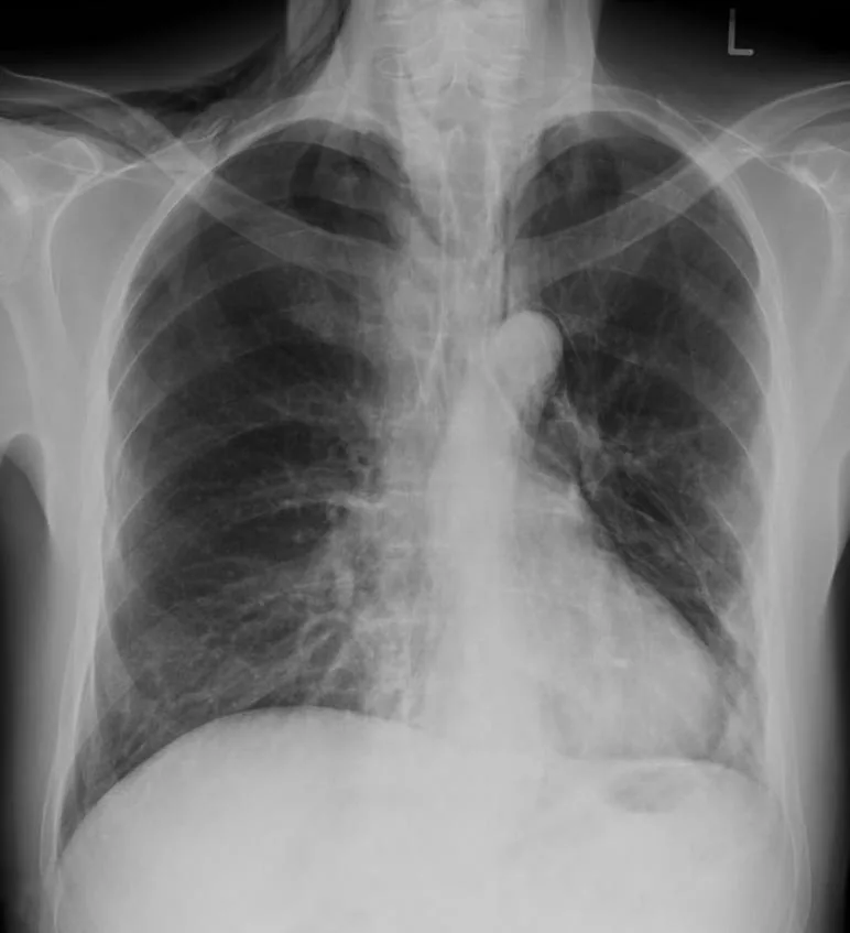Chest radiograph for self-assessment