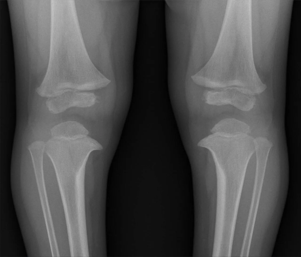 Paediatric radiograph for self-assessment