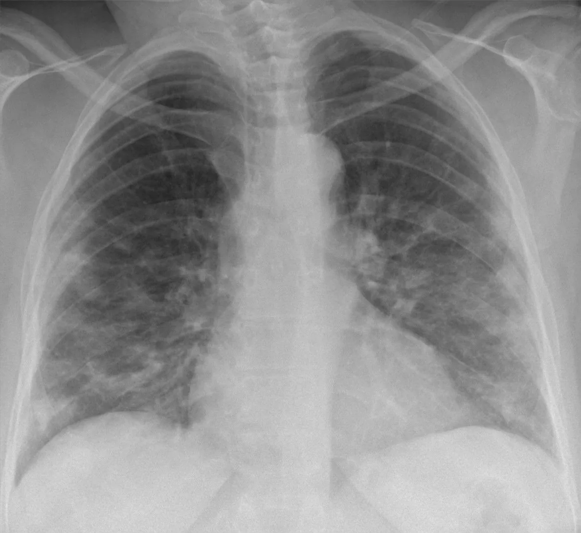 Chest radiograph for self-assessment