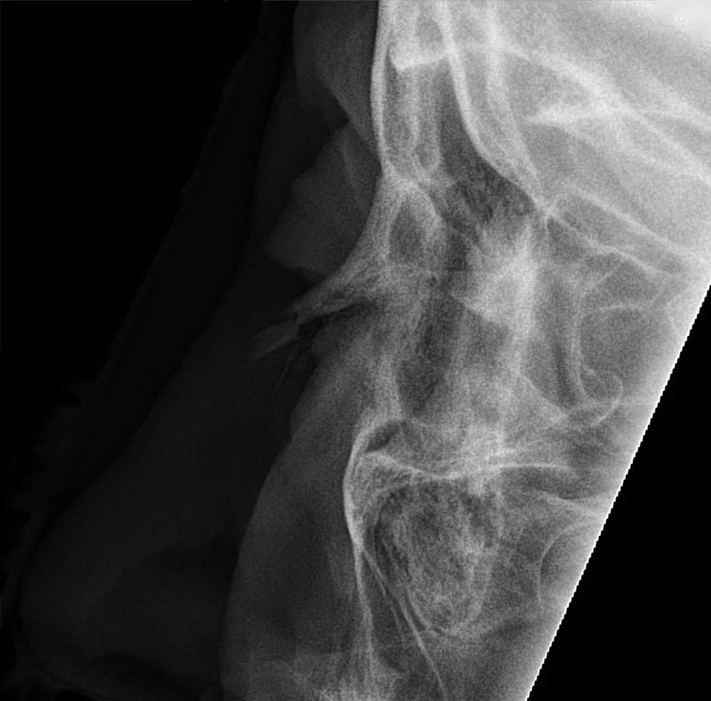 Skull & face radiograph for self-assessment