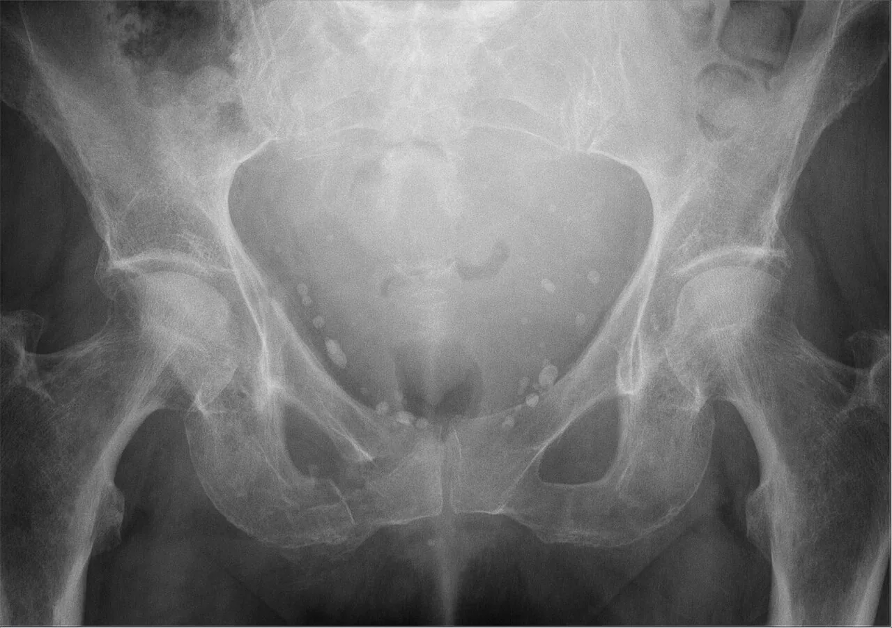 Abdomen radiograph for self-assessment