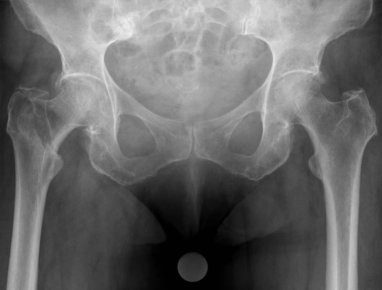 Lower limb radiograph for self-assessment