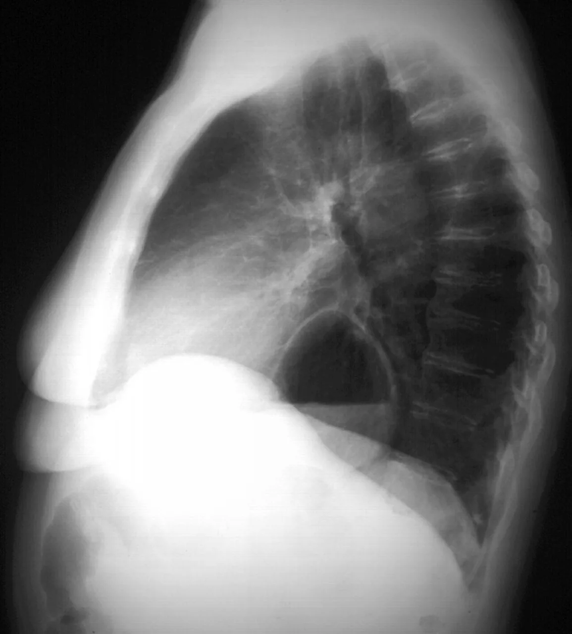 Chest radiograph for self-assessment