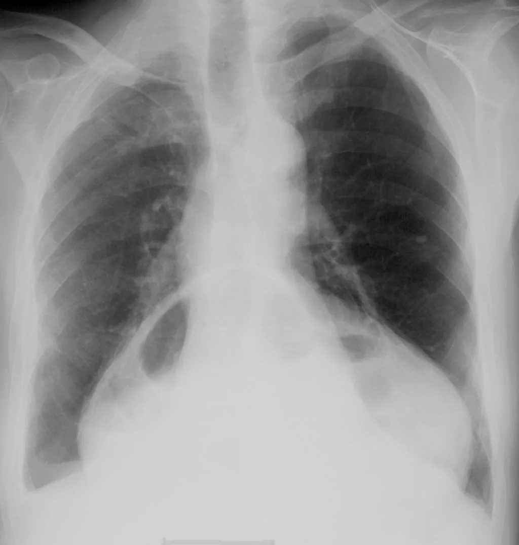 Chest radiograph for self-assessment