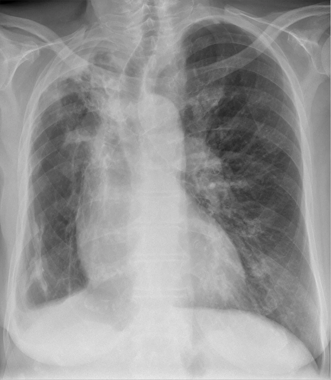 Chest radiograph for self-assessment