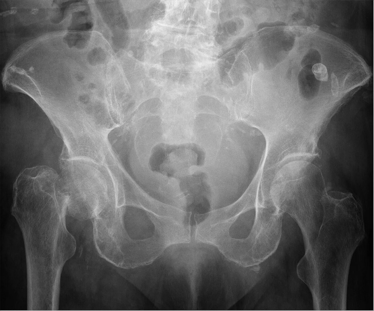 Lower limb radiograph for self-assessment