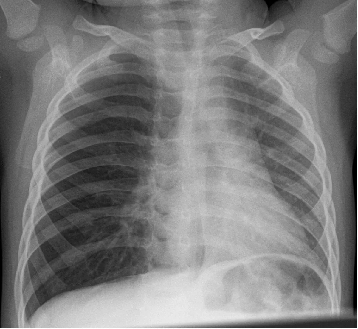 Paediatric radiograph for self-assessment