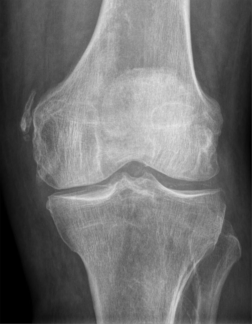 Lower limb radiograph for self-assessment