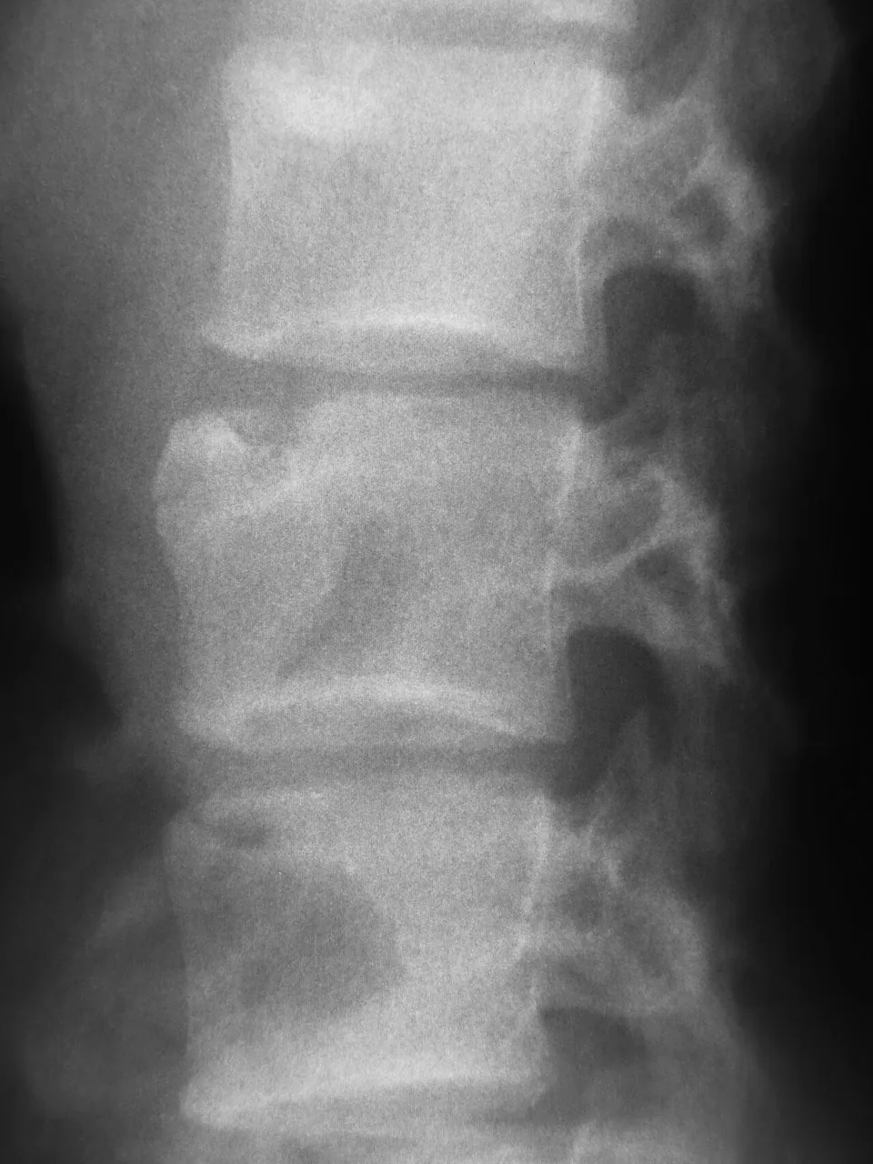 Bone & joint disease radiograph for self-assessment