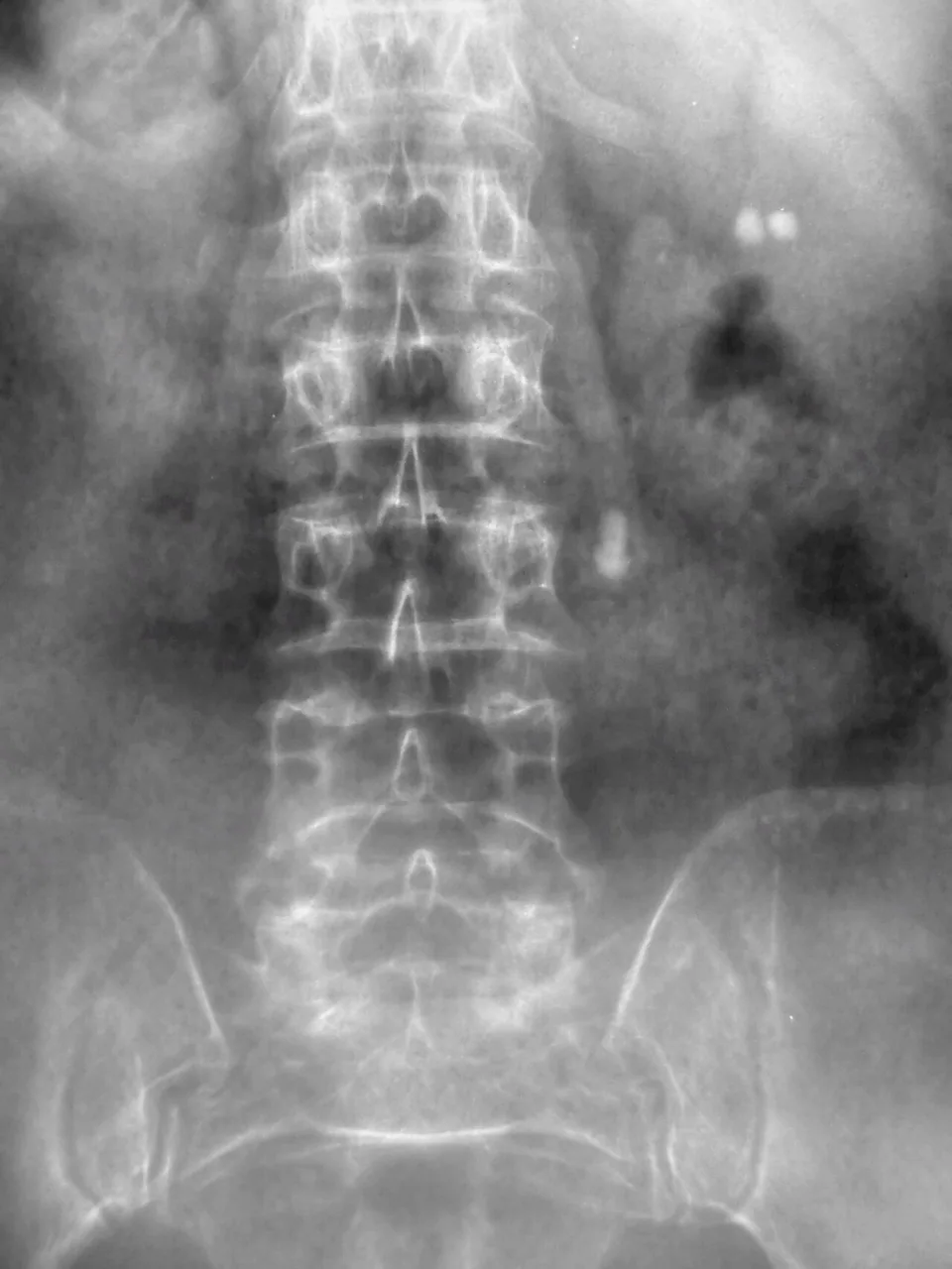Abdomen radiograph for self-assessment