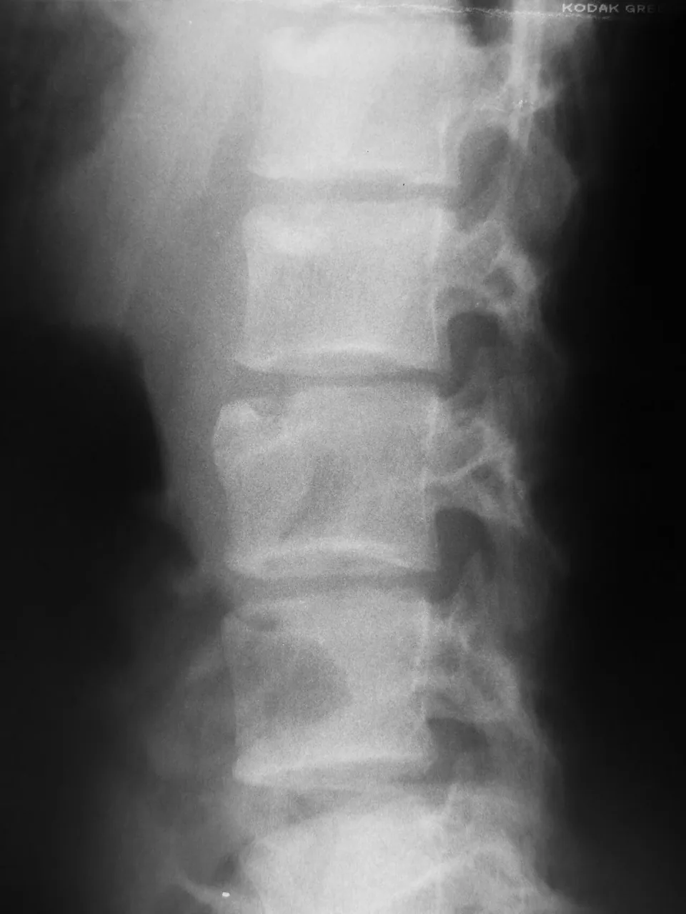 Bone & joint disease radiograph for self-assessment
