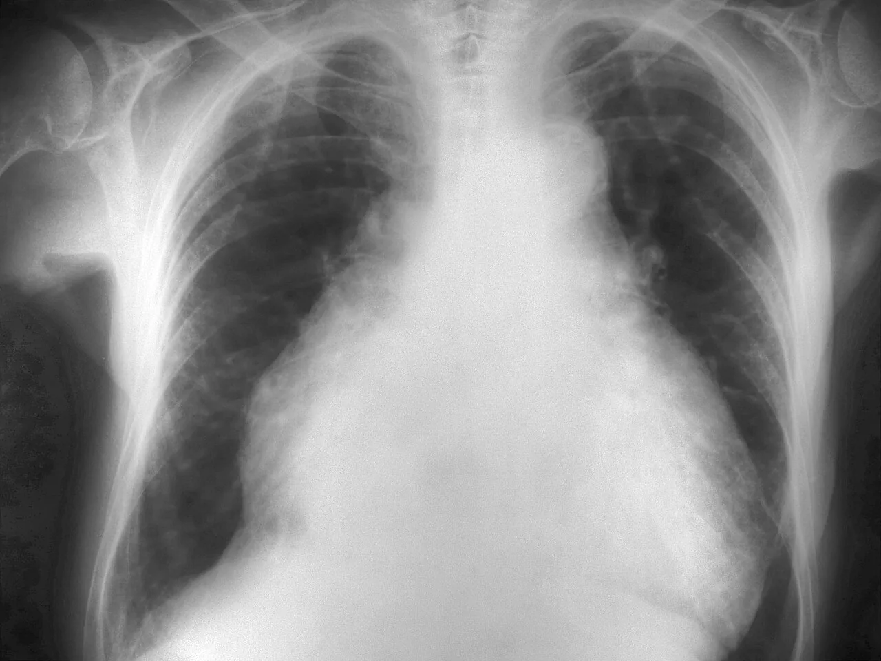 Chest radiograph for self-assessment