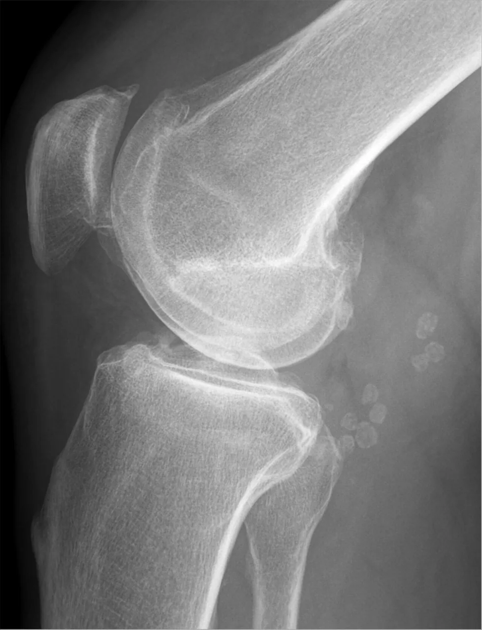 Bone & joint disease radiograph for self-assessment
