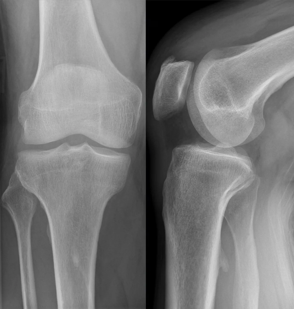 Bone & joint disease radiograph for self-assessment