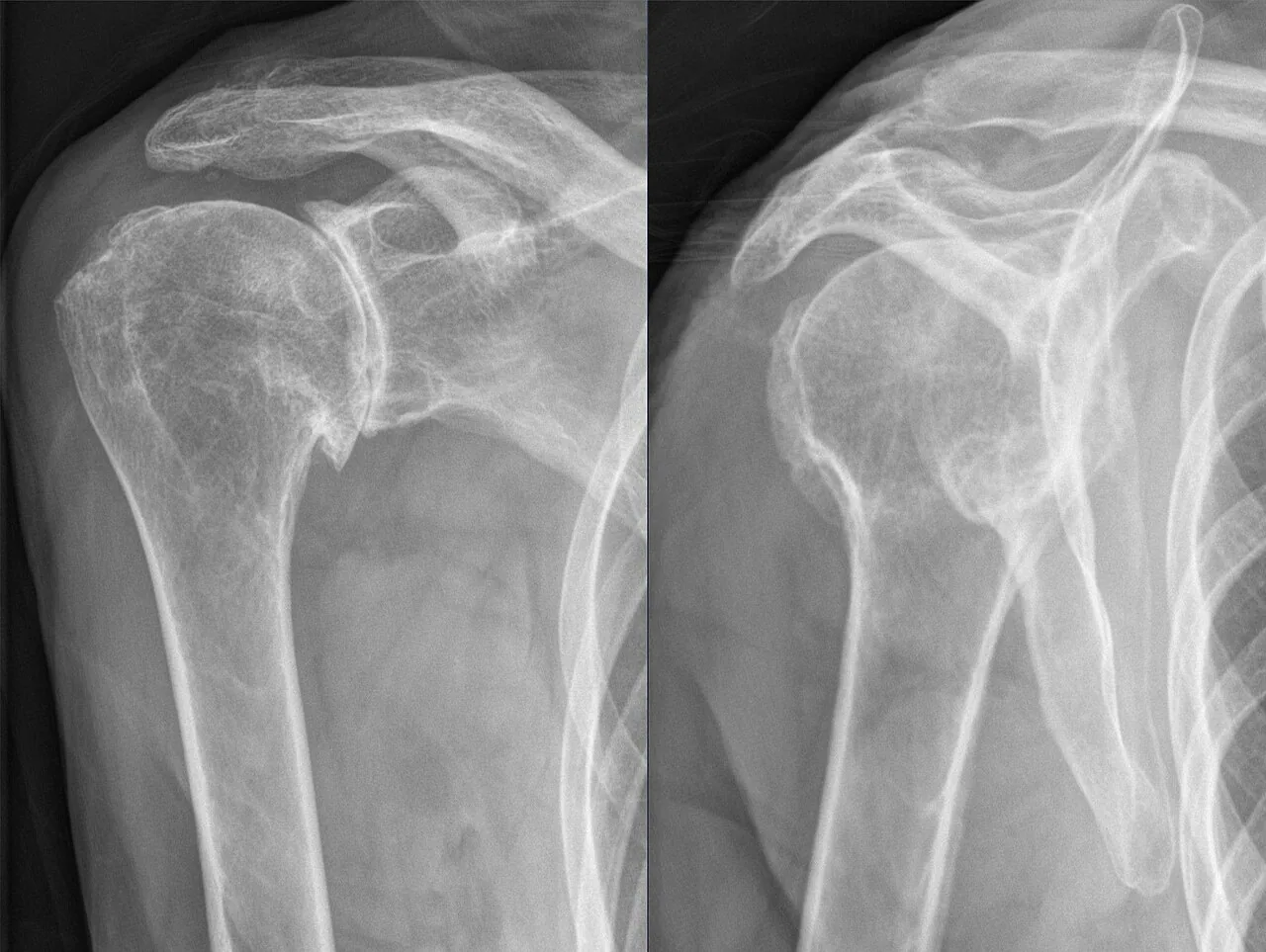 Bone & joint disease radiograph for self-assessment