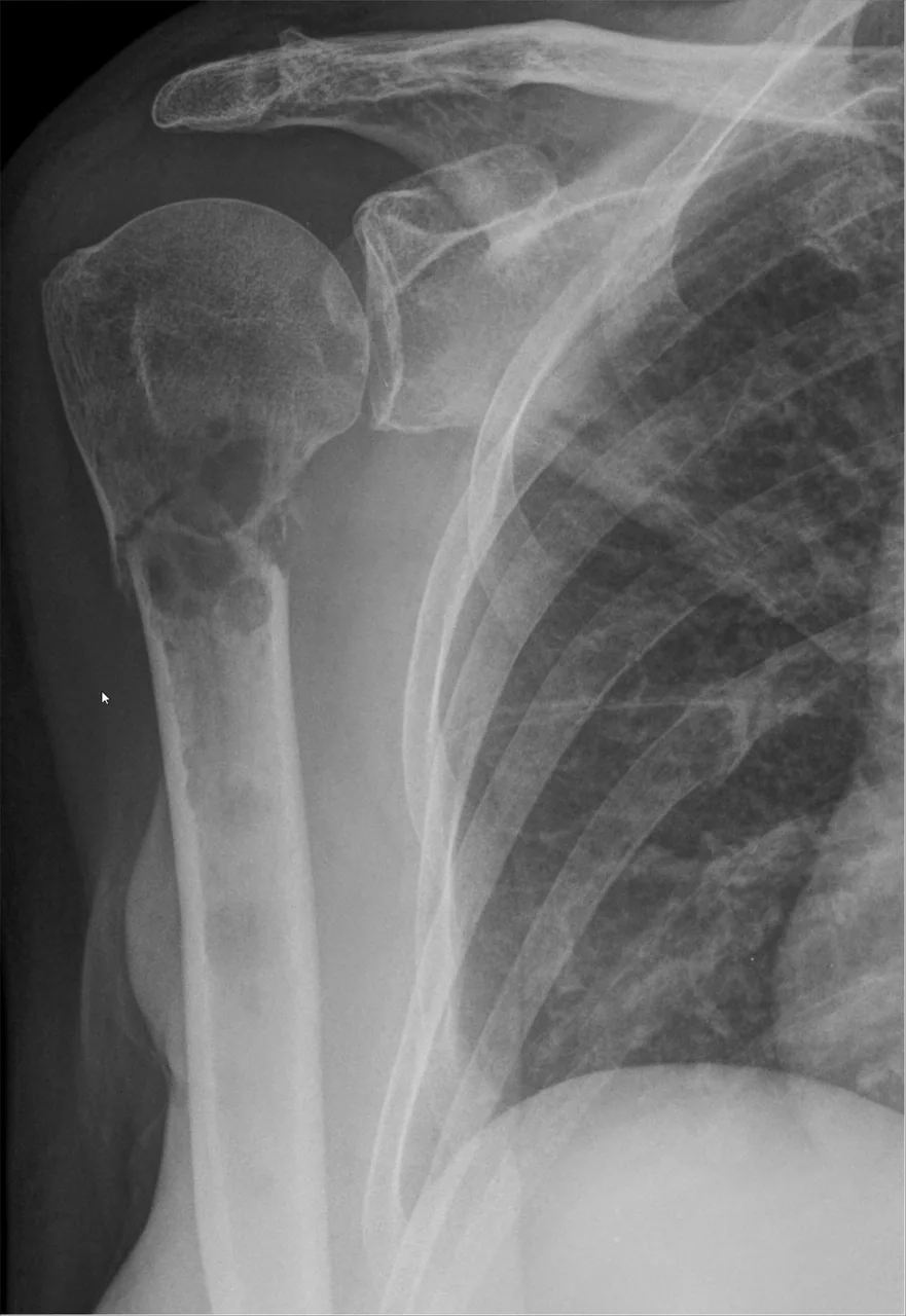 Bone & joint disease radiograph for self-assessment