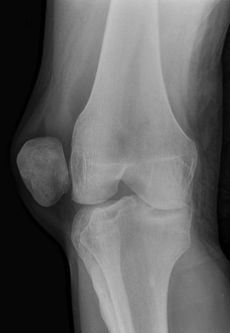 Lower limb radiograph for self-assessment