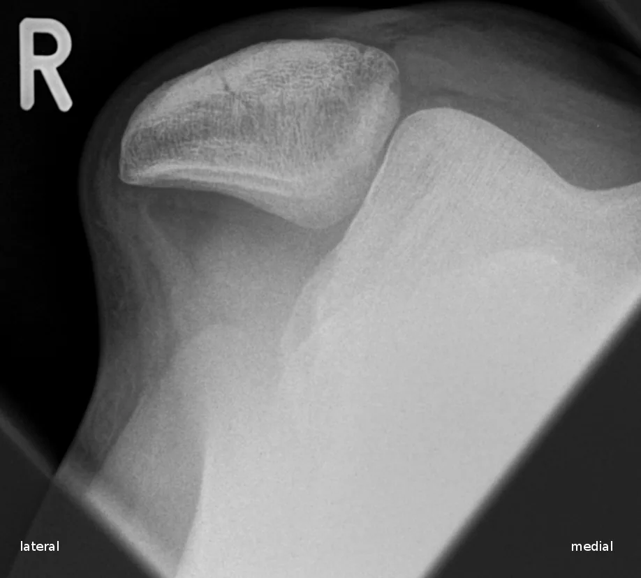 Lower limb radiograph for self-assessment