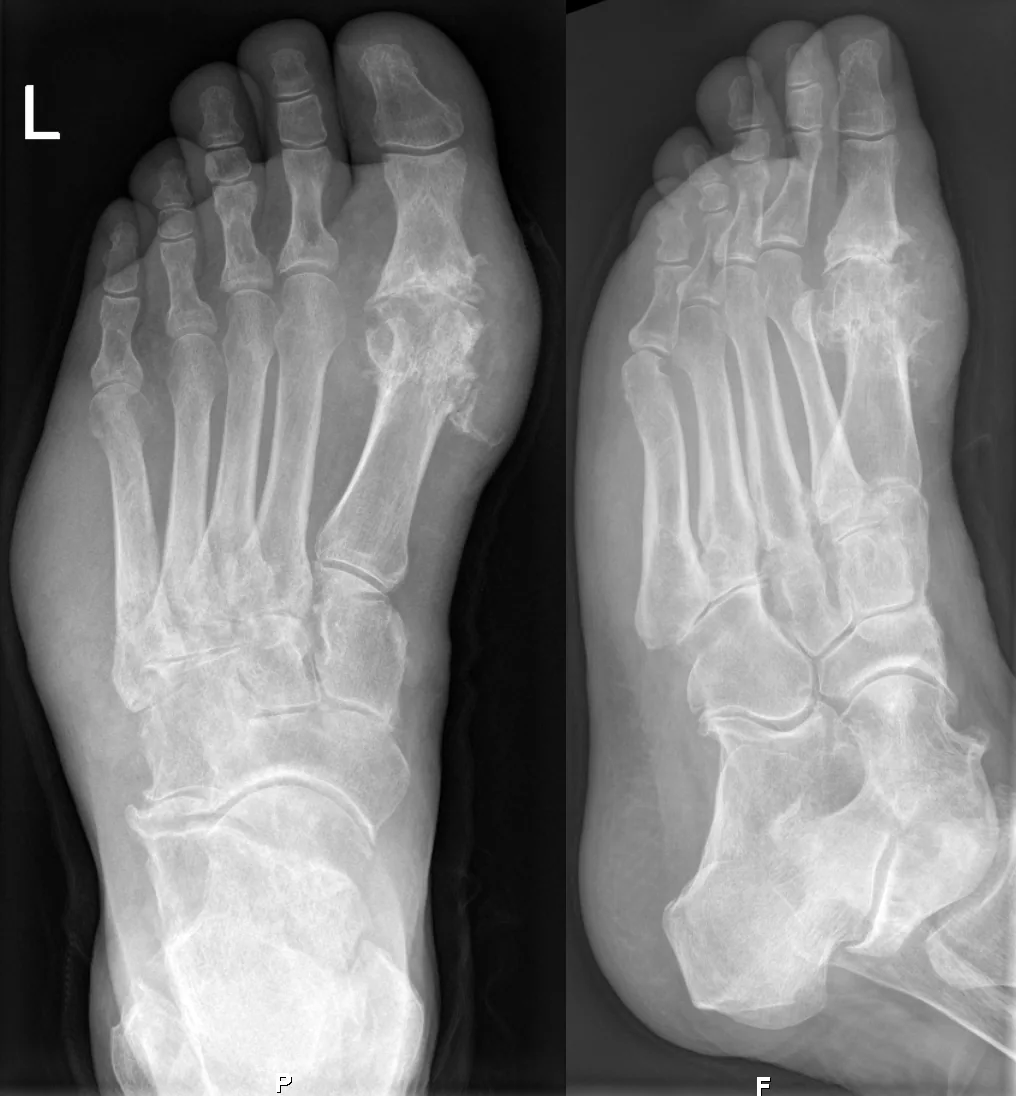 Bone & joint disease radiograph for self-assessment