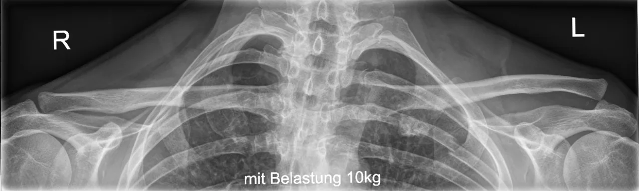 Upper limb radiograph for self-assessment