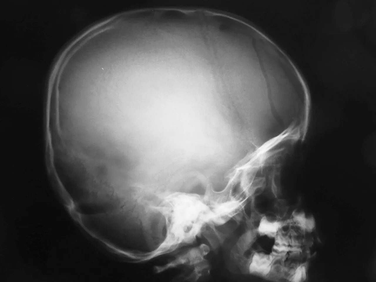 Skull & face radiograph for self-assessment