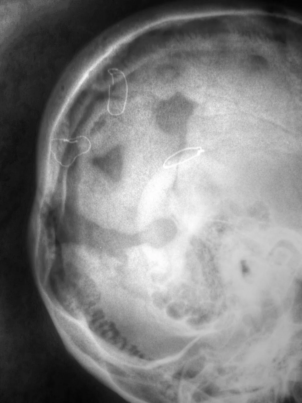 Skull & face radiograph for self-assessment