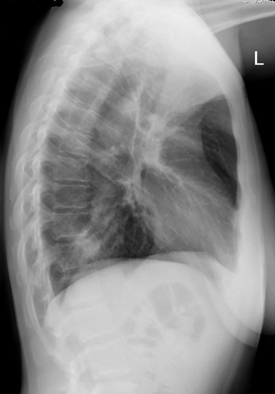 Chest radiograph for self-assessment