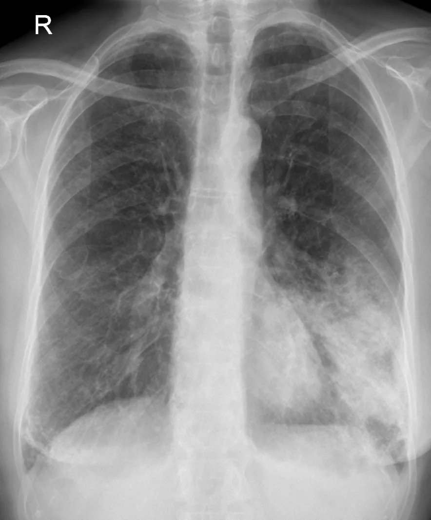 Chest radiograph for self-assessment