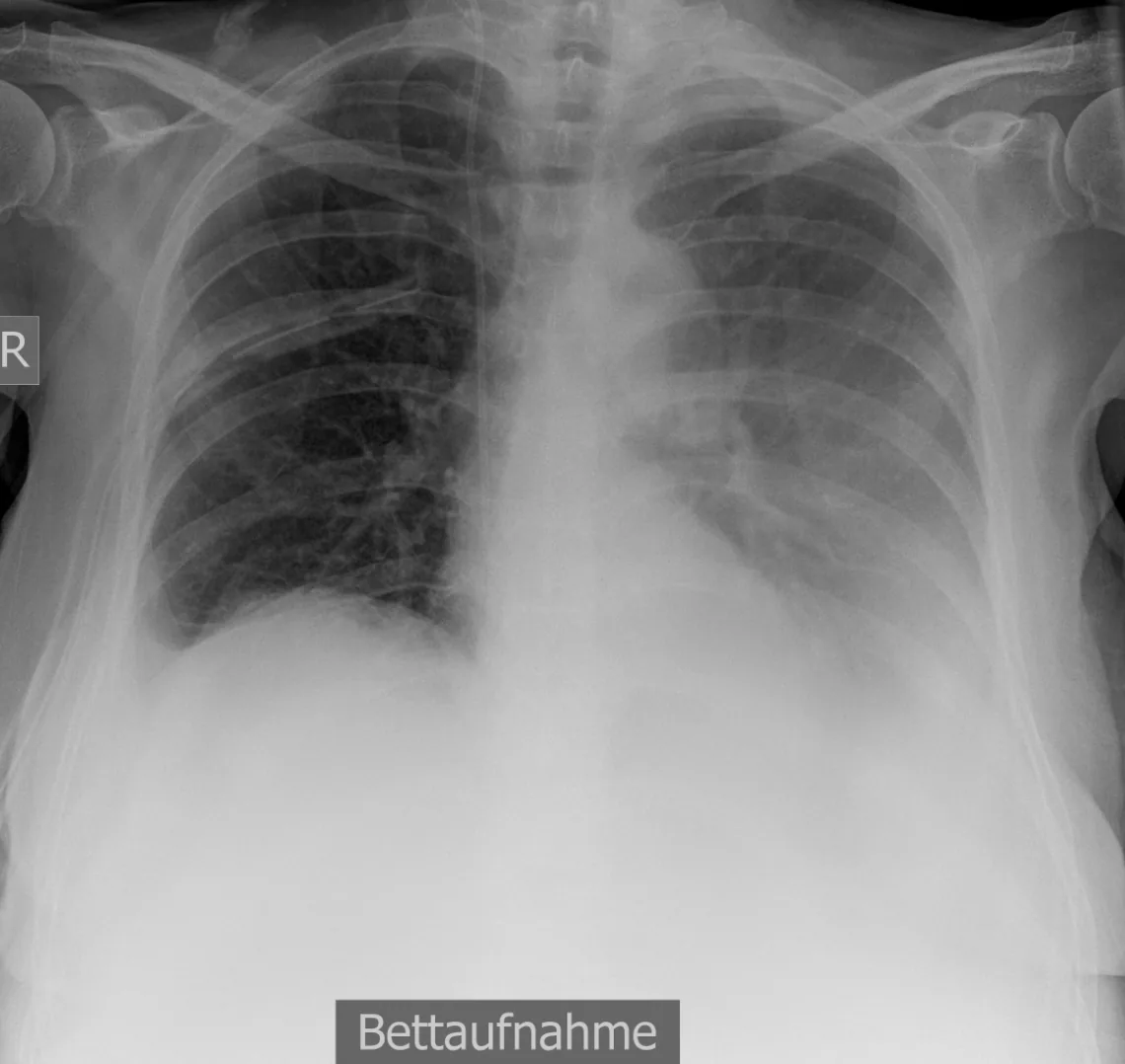 Chest radiograph for self-assessment