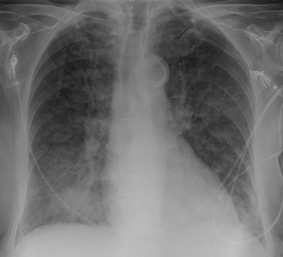 Chest radiograph for self-assessment