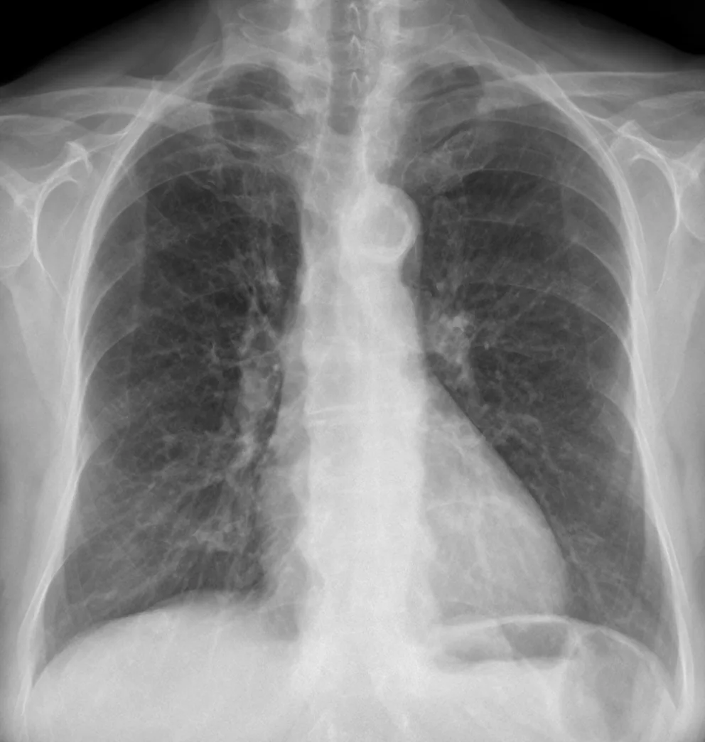 Chest radiograph for self-assessment