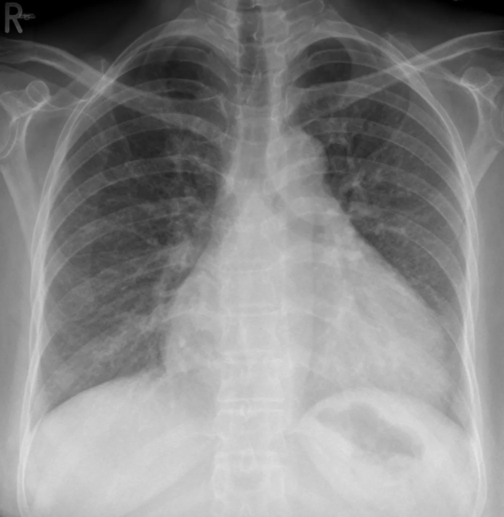 Chest radiograph for self-assessment