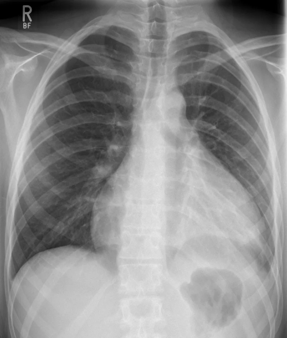 Chest radiograph for self-assessment