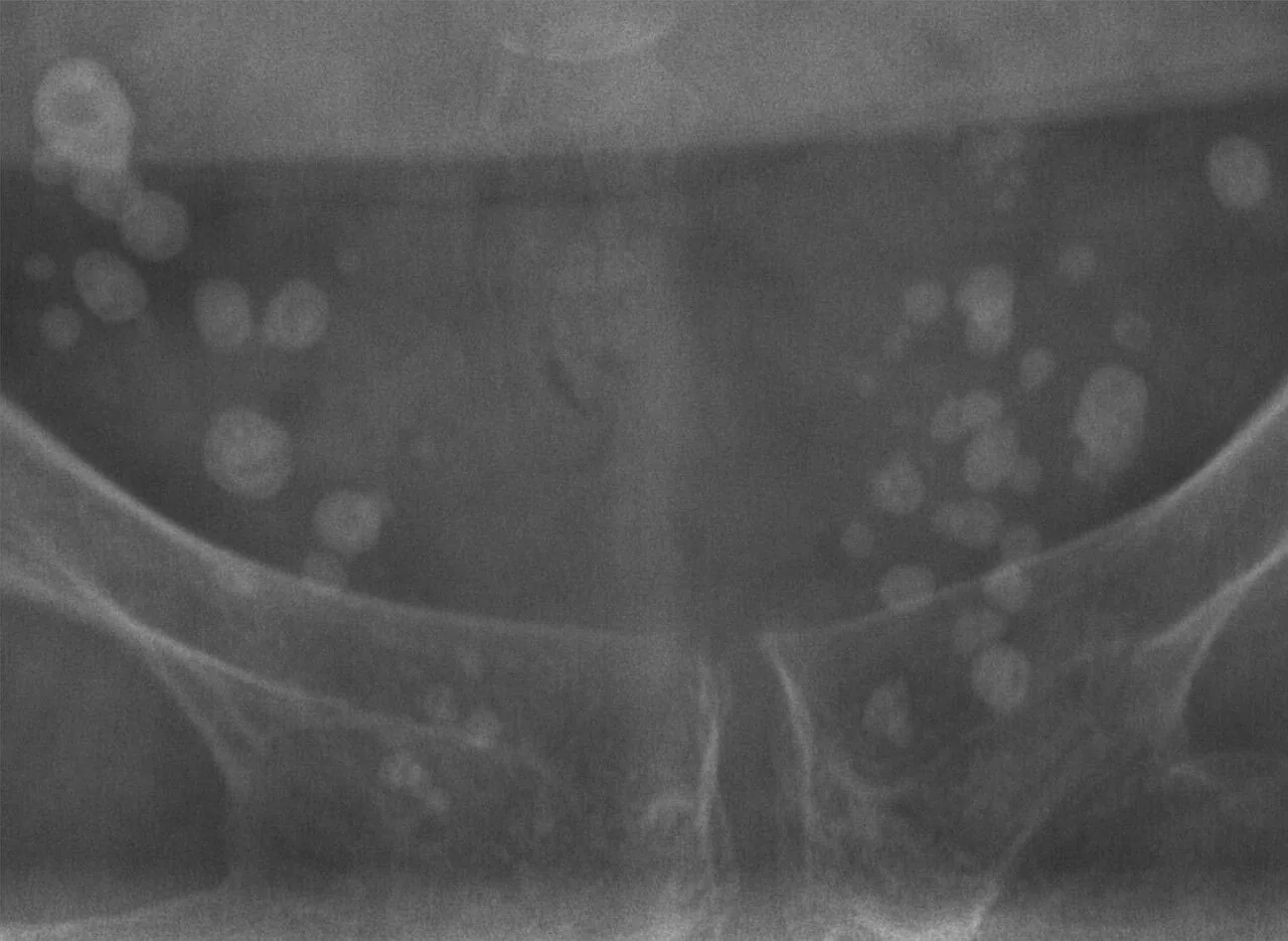 Abdomen radiograph for self-assessment